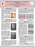 Evaluation of enamel cracks characteristics after removal of metal brackets in adult patients